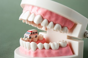 歯周病とは？